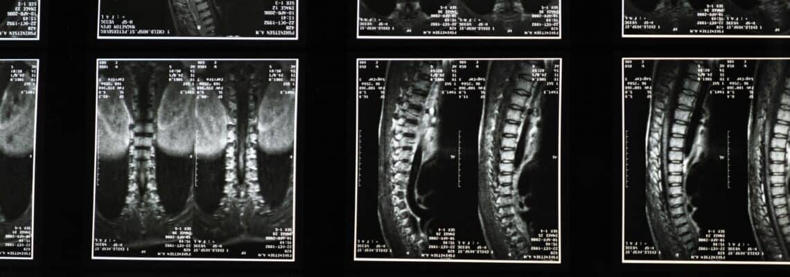 Top Rules to Follow Before a Radiology Test