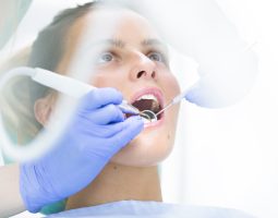 Wisdom Teeth Extraction