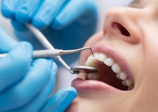 Best Dentist in Mount Waverley