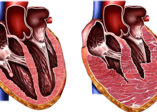 Best Cardiologist in Swansea