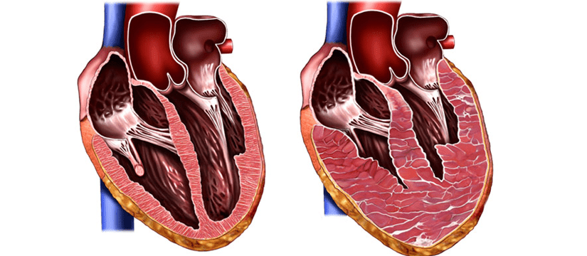 Best Cardiologist in Swansea