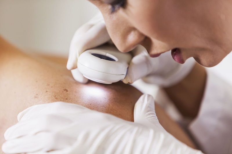 Best Dermatology in Deception Bay