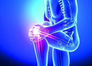 Best Orthopaedic surgeon in Canberra