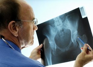 Best Orthopaedic surgeon in Sydney