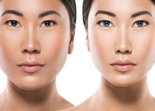 Best Plastic Surgeon in Redcliffe