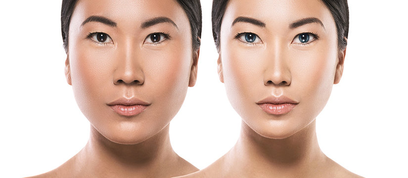 Best Plastic Surgeon in Redcliffe