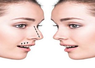 Best Plastic Surgeon in Shepparton