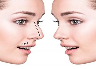 Best Plastic Surgeon in Traralgon