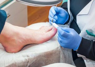 Best Podiatrist in Bairnsdale