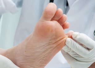 Best Podiatrist in Canberra