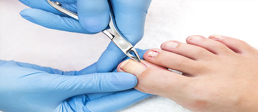 Best Podiatrist in Cooma