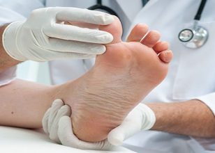 Best Podiatrist in Fairy Meadow