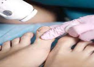 Best Podiatrist in Goulburn