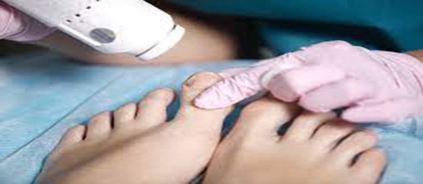 Best Podiatrist in Goulburn