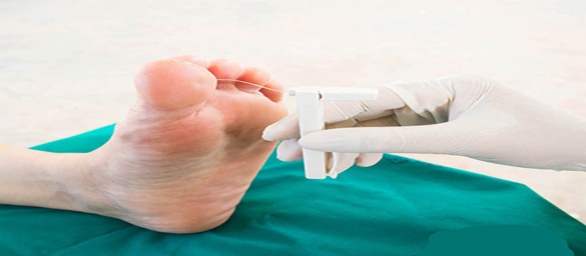 Best Podiatrist in Mackay