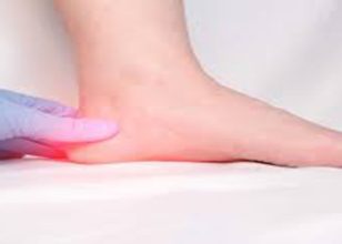 Best Podiatrist in Mount Waverley