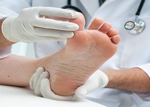 Best Podiatrist in Parkes