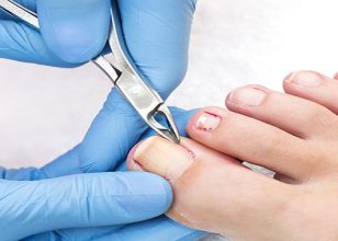 Best Podiatrist in Yeppoon