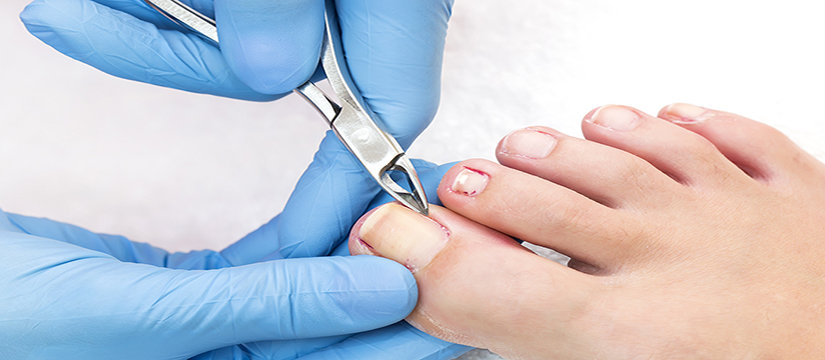 Best Podiatrist in Yeppoon