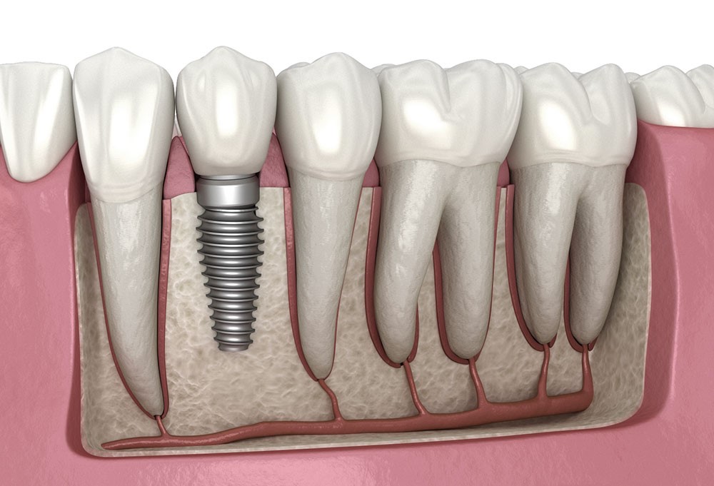 Injectable procedures