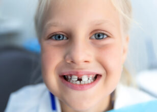 How Teeth Gaps Affect Your Overall Health