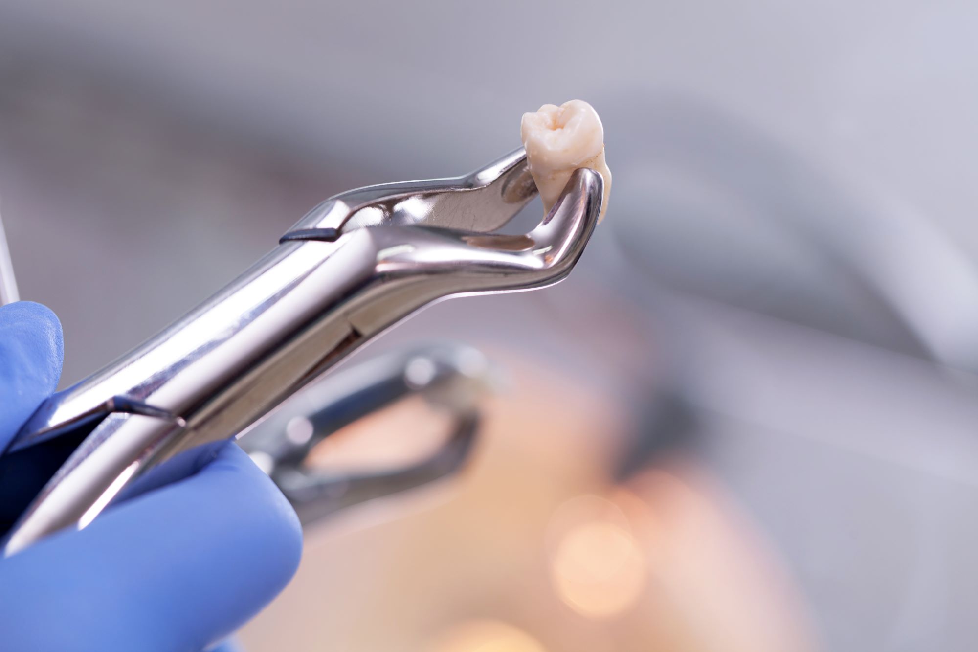 Tooth extraction