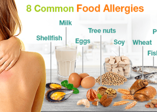 8 Common Allergies in Children