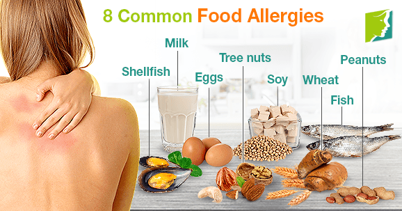 8 Common Allergies in Children