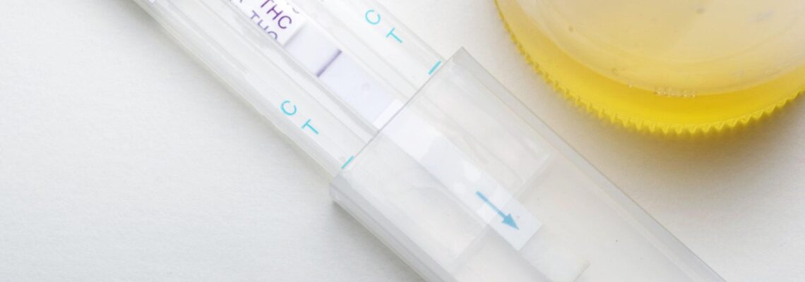 How Can Home Drug Testing Kits Help You?